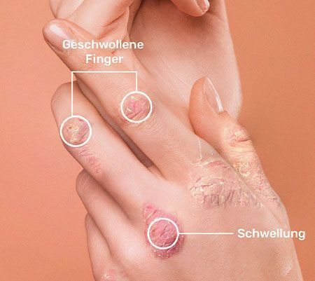 Tool direct ePsA-Screening für Ärzte background